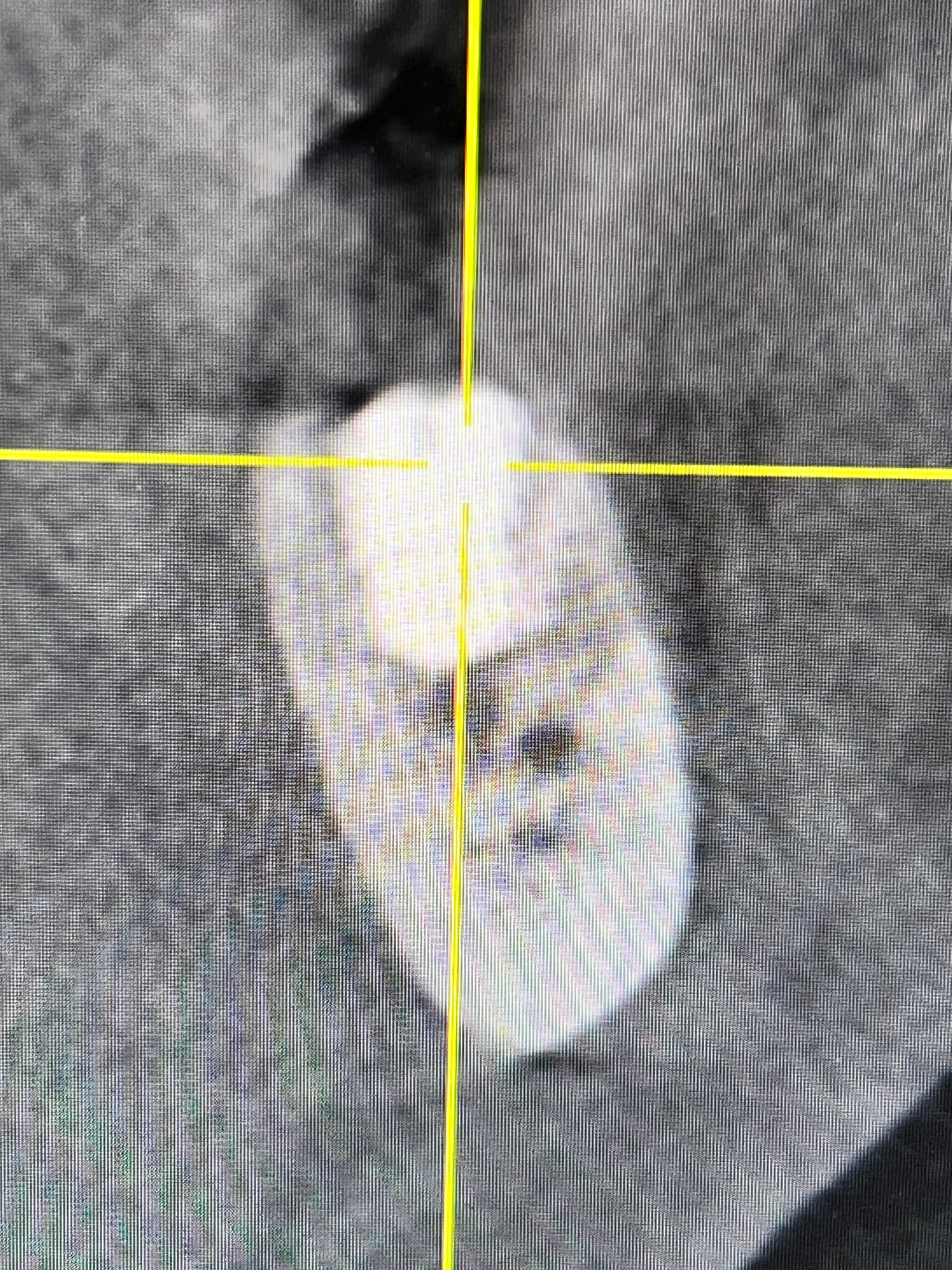 Dental implant procedure